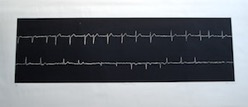 A Heartbeat Away, 2001, by Zarina
